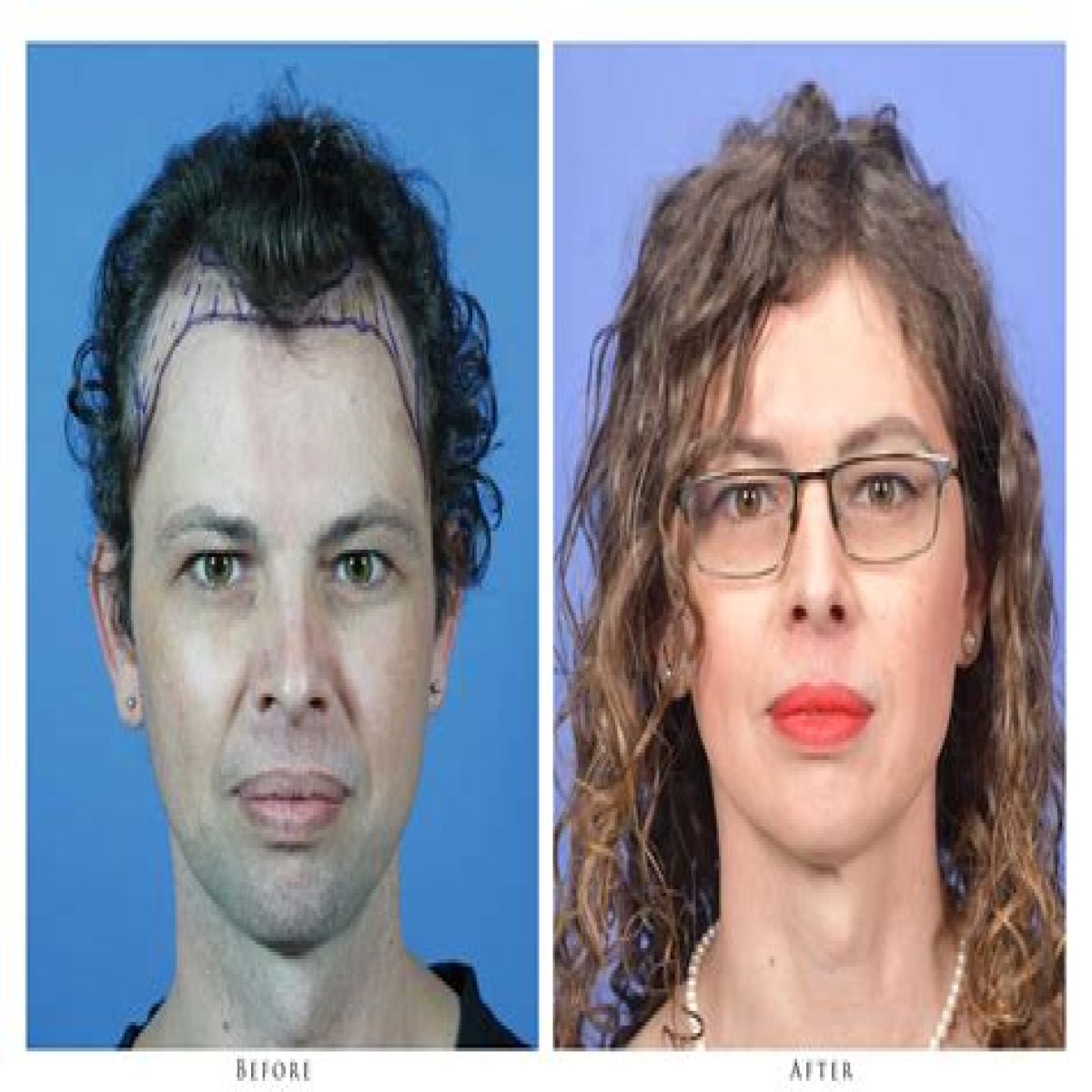 Before and after transgender photos