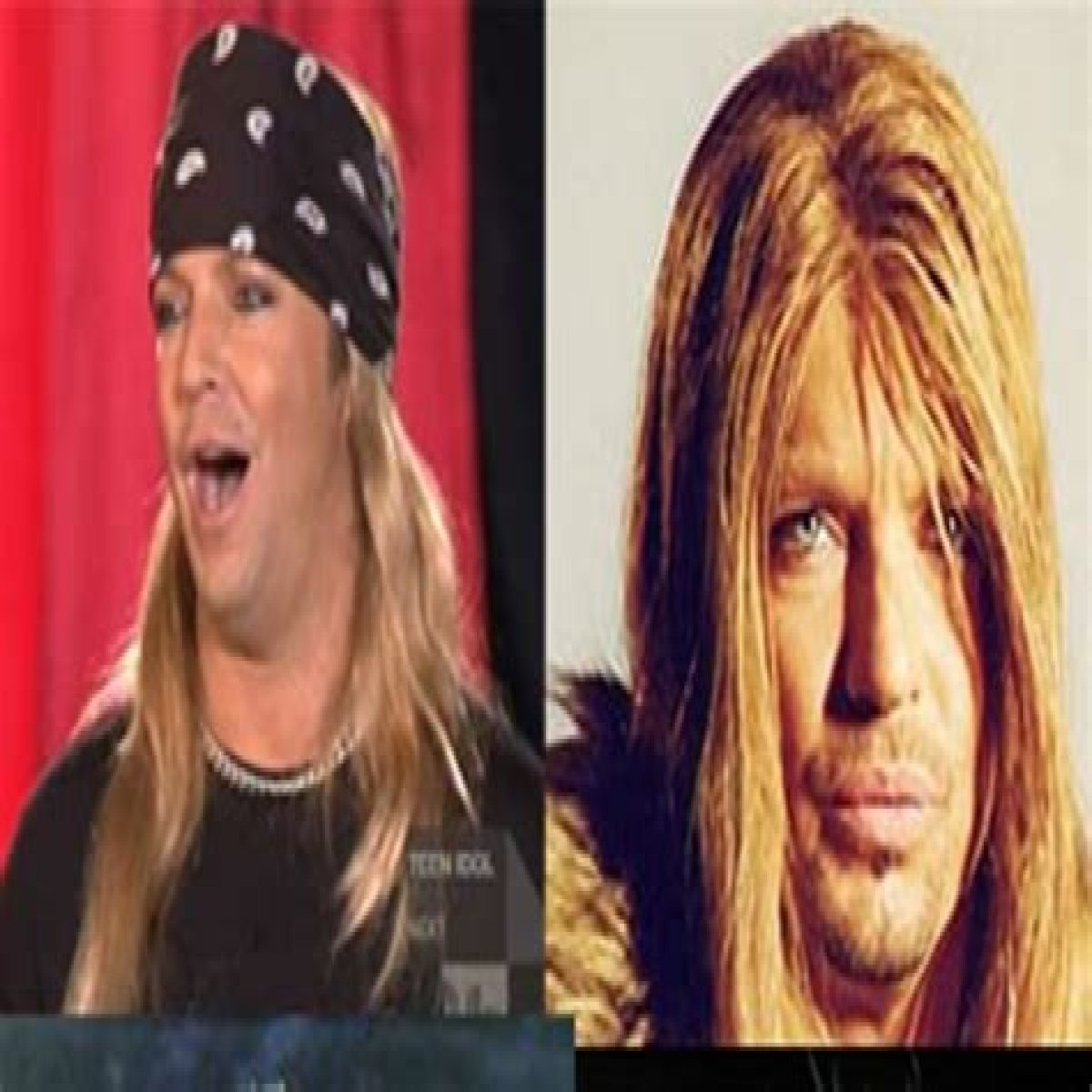 Bret Michaels' Hairline: The Unfiltered Truth Revealed