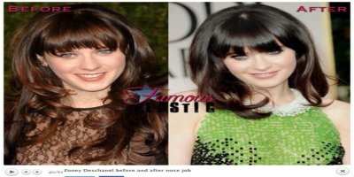   Celebrity Dating Game: Zooey Deschanel plastic surgery rumours debunked!    Tue 15 June 2021 02:00    Updated Tue 15 June 2021 09:02    Helen Williams    