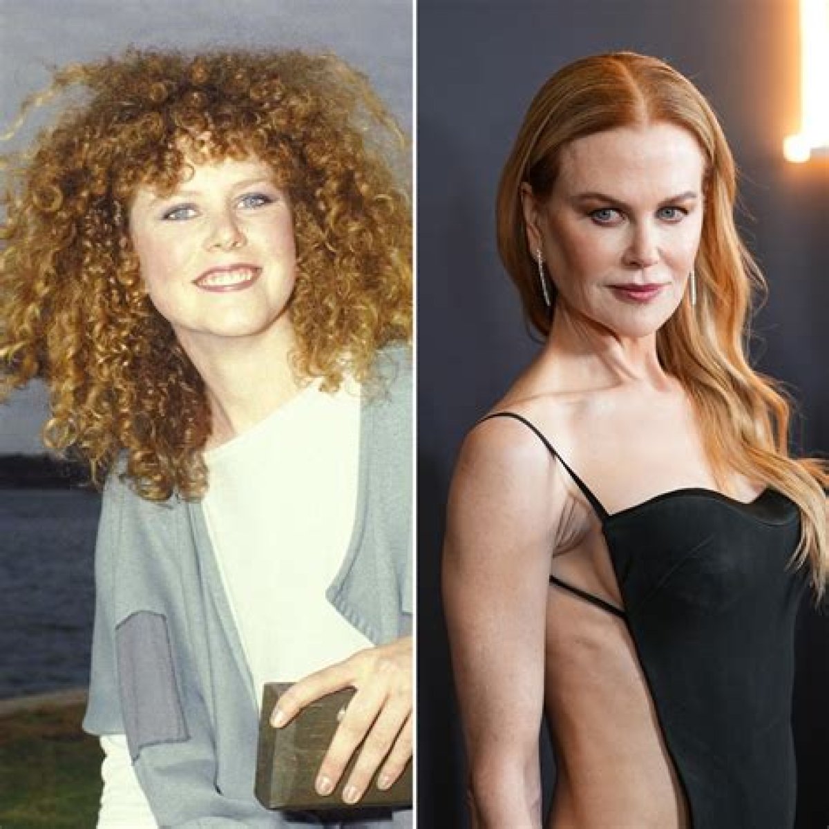 See before and after surgery photos