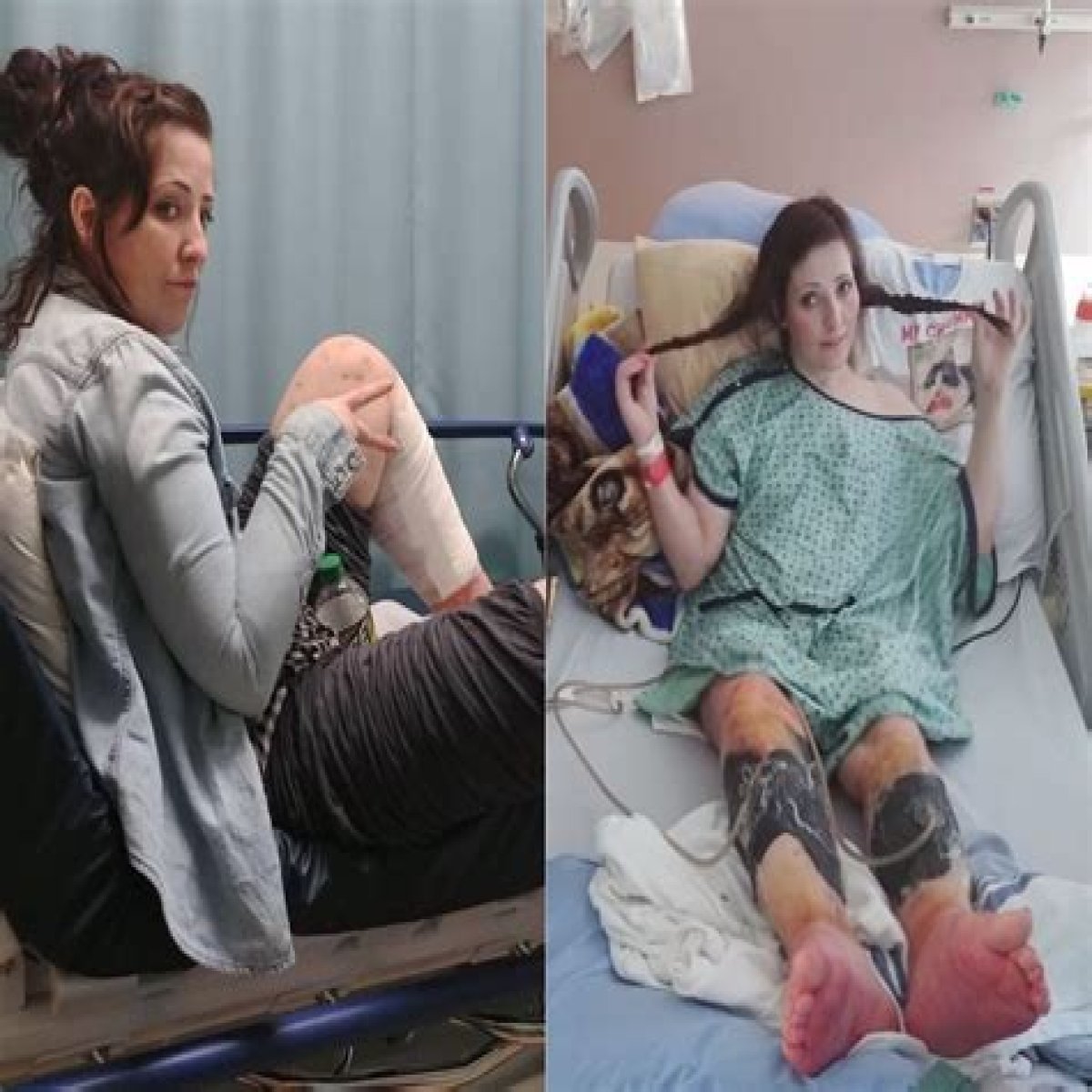 What did Kelly Ronahan do to her legs?